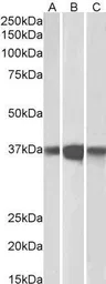 Anti-PP2A alpha + PP2A beta antibody, C-term used in Western Blot (WB). GTX89984