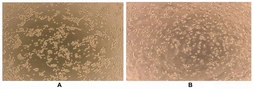 Human Interferon gamma protein, His tag (active). GTX00084-pro