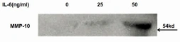 Rat IL6 protein, His tag (active). GTX00341-pro