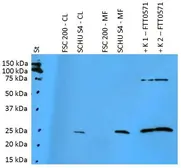 Anti-F. t. tularensis FTT0571 antibody [PAb (181)] used in Western Blot (WB). GTX00501