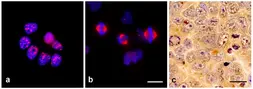 Anti-TPX2 antibody [TPX2-01] used in Immunocytochemistry/ Immunofluorescence (ICC/IF). GTX00510