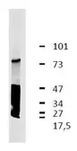 Anti-GARP antibody [GARP5] used in Western Blot (WB). GTX00516