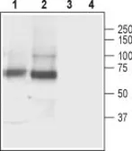 Anti-GAT3 antibody used in Western Blot (WB). GTX00634