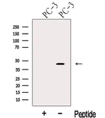 Anti-KLF6 antibody used in Western Blot (WB). GTX00646