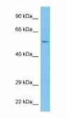 Anti-CMPK2 antibody used in Western Blot (WB). GTX00670