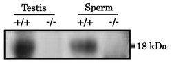 Anti-PMIS2 antibody used in Western Blot (WB). GTX00748