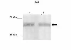 Anti-ID4 antibody used in Western Blot (WB). GTX00771