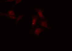 Anti-DARPP-32 (phospho Thr75) antibody used in Immunocytochemistry/ Immunofluorescence (ICC/IF). GTX00803
