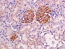 Anti-NPHS2 antibody used in IHC (Paraffin sections) (IHC-P). GTX00821