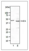 Anti-Campylobacter Porin antibody [cj-01] used in Western Blot (WB). GTX00867