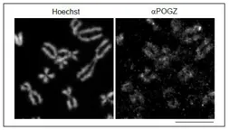 Anti-Pogz antibody used in Immunocytochemistry/ Immunofluorescence (ICC/IF). GTX00892