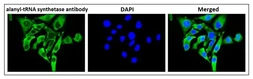 Anti-alanyl-tRNA synthetase antibody used in Immunocytochemistry/ Immunofluorescence (ICC/IF). GTX00903
