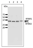 Anti-Root FNR antibody used in Western Blot (WB). GTX00909
