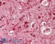 Anti-ASCL3 antibody used in IHC (Paraffin sections) (IHC-P). GTX01091