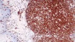 Anti-CD45 antibody [X16/99] used in IHC (Paraffin sections) (IHC-P). GTX01850