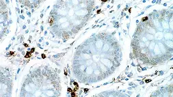 Anti-IL6 antibody [10C12] used in IHC (Paraffin sections) (IHC-P). GTX01893