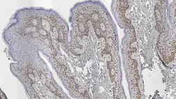 Anti-Androgen Receptor antibody [AR27] used in IHC (Paraffin sections) (IHC-P). GTX01898