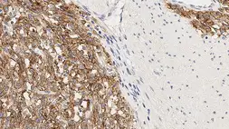Anti-TMEM16A antibody [K9] used in IHC (Paraffin sections) (IHC-P). GTX01933