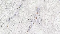 Anti-Mast cell tryptase antibody [10D11] used in IHC (Paraffin sections) (IHC-P). GTX01964