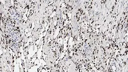 Anti-KSHV ORF73 antibody [13B10] used in IHC (Paraffin sections) (IHC-P). GTX01981