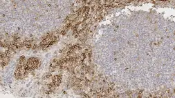 Anti-CD99 antibody [PCB1] used in IHC (Paraffin sections) (IHC-P). GTX01982
