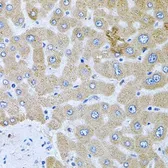 Anti-POMGNT1 antibody used in IHC (Paraffin sections) (IHC-P). GTX02543
