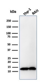 Anti-beta 2 Microglobulin antibody [B2M/1857R] used in Western Blot (WB). GTX02596