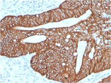 Anti-Cytokeratin 18 antibody [KRT18/2819R] used in IHC (Paraffin sections) (IHC-P). GTX02658