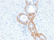 Anti-Cytokeratin 2 antibody [rKRTH/2148] used in IHC (Paraffin sections) (IHC-P). GTX02664