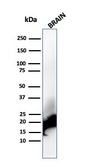 Anti-Myelin basic protein antibody [rMBP/4288] used in Western Blot (WB). GTX02673