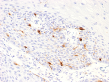 Anti-TRP1 antibody [TYRP1/2340R] used in IHC (Paraffin sections) (IHC-P). GTX02736