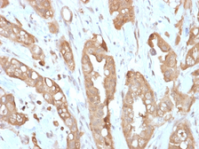 Anti-Villin antibody [VIL1/2310R] used in IHC (Paraffin sections) (IHC-P). GTX02740