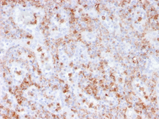 Anti-S100A8 + S100A9 antibody [rMAC3781] used in IHC (Paraffin sections) (IHC-P). GTX02752