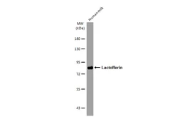 Anti-Lactofferin antibody [2-18-1] used in Western Blot (WB). GTX02809