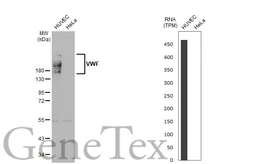 Anti-VWF antibody [GT1230] used in Western Blot (WB). GTX02827