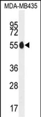 Anti-PAX1 antibody used in Western Blot (WB). GTX02871