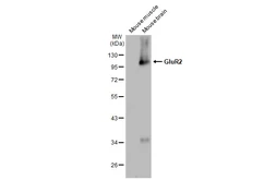 Anti-GluR2 antibody [GT1283] used in Western Blot (WB). GTX03195