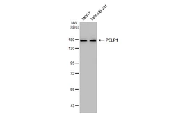 Anti-PELP1 antibody [GT1339] used in Western Blot (WB). GTX03251