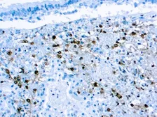 Anti-HSV2 gD antibody [DBM15.69] used in IHC (Paraffin sections) (IHC-P). GTX03305