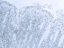 Anti-Helicobacter pylori antibody used in IHC (Paraffin sections) (IHC-P). GTX03330