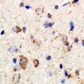Anti-GABA A Receptor beta 2 antibody used in IHC (Paraffin sections) (IHC-P). GTX03471