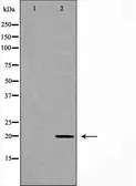 Anti-RAMP2 antibody used in Western Blot (WB). GTX03586