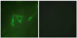Anti-14-3-3 zeta antibody used in Immunocytochemistry/ Immunofluorescence (ICC/IF). GTX03589