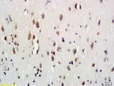 Anti-GCSF Receptor antibody used in IHC (Paraffin sections) (IHC-P). GTX03643