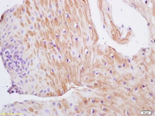 Anti-TIMP1 antibody used in IHC (Paraffin sections) (IHC-P). GTX03714