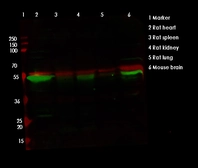 Anti-TFEB antibody used in Western Blot (WB). GTX04086