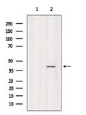 Anti-RFC4 antibody used in Western Blot (WB). GTX04241