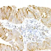 Anti-USP18 antibody used in IHC (Paraffin sections) (IHC-P). GTX04331