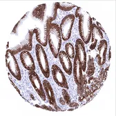 Anti-Cytokeratin 18 antibody [MSVA-118R] HistoMAX&trade; used in IHC (Paraffin sections) (IHC-P). GTX04374