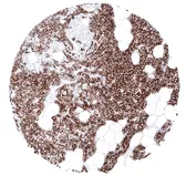 Anti-Parathyroid Hormone antibody [MSVA-525R] HistoMAX&trade; used in IHC (Paraffin sections) (IHC-P). GTX04405